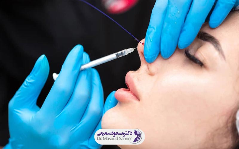 هزینه لیفت بینی با نخ 3 هزینه لیفت بینی با نخ